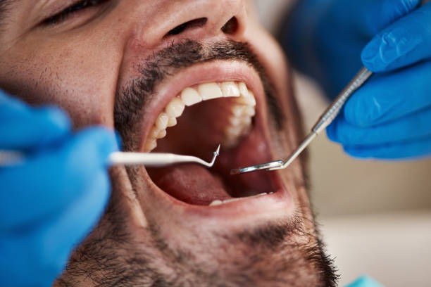 Best Emergency Root Canal Therapy in Rector, AR